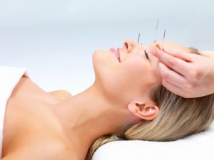 cosmeticAcupuncture